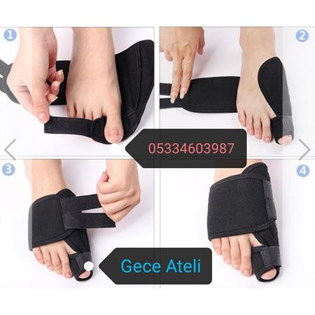 Halluks Valgus Gece Ateli