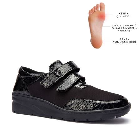 1170 BURÇ SİYAH HALLUKS VALGUS COMFORT