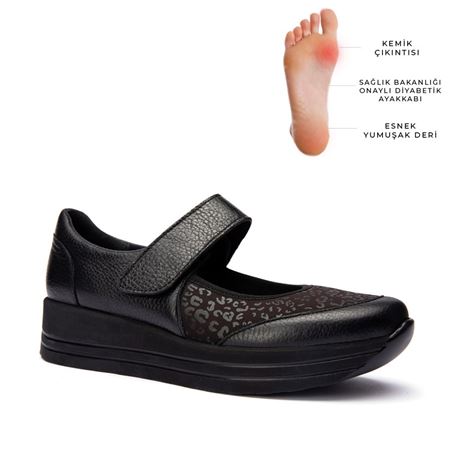 19107 Siyah Halluks Valgus ve Rigidus Ayakkabısı