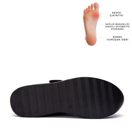 19107 Siyah Halluks Valgus ve Rigidus Ayakkabısı
