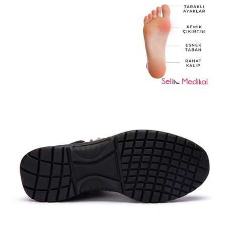 19204 VİSON SUET BOT -  BUNYON KEMİK ÇIKINTISINA UYGUN SKETCHERS ESNEK TABAN 