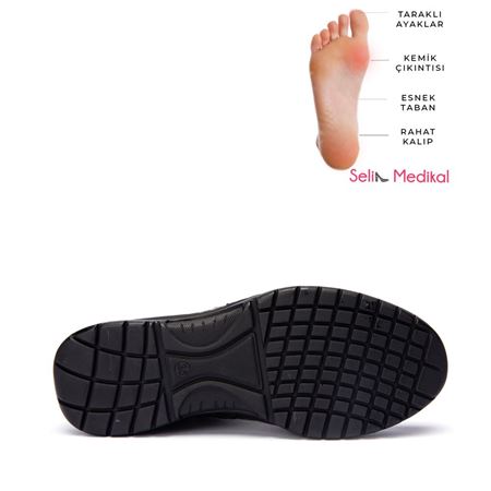 19204 SİYAH MİMOZA BOT BUNYON KEMİK ÇIKINTISINA UYGUN  ESNEK TABAN