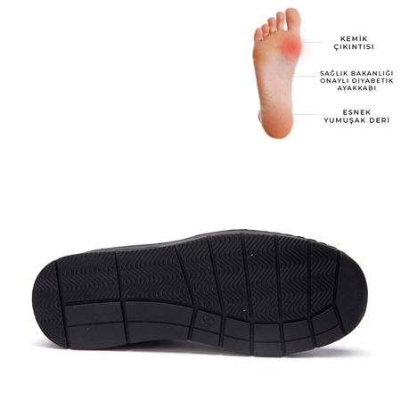 17101 Siyah Rugan Halluks Valgus Comfort
