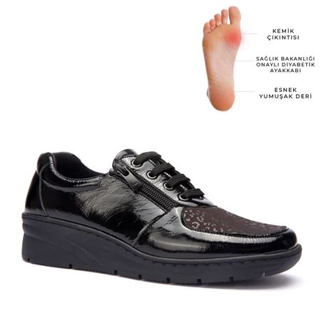 17101 Siyah Rugan Halluks Valgus Comfort