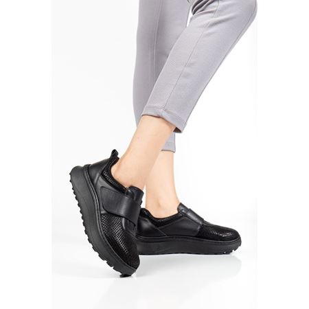 15001 Siyah Halluks Valgus ve Rigidus Ortopedik Ayakkabı