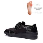 1170 BURÇ SİYAH HALLUKS VALGUS COMFORT