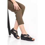 6928 SİYAH CMB HAKİKİ DERİ HALLUKS VALGUS ORTOPEDİK TABANI ÇIKABİLEN YAZLIK AYAKKABI